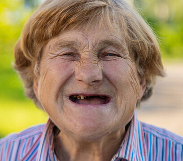 Patient's smile before treatment